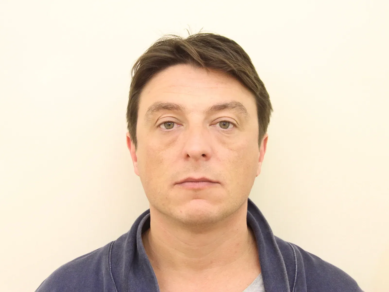 Same male patient one year after a third masseter Botox treatment at Cosmedocs — maintained slimmer jaw and refined lower face